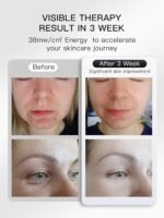 Red Light Therapy for Face, LED Face Mask Infrared Light Anti-Aging, 3 Modes for Blue & Yellow LED for Home, Yoga, Skincare, 2500mAh Rechargeable Remote Control, Adjustable Straps, Silicone - Image 7