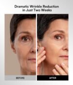 INIA Red Light Therapy Mask for Face, Glow Wireless LED Face Mask Light Therapy with Near-Infrared Red Light (NIR), Rechargeable and Ergonomic Design for Home & Travel - Image 4