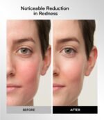 INIA Red Light Therapy Mask for Face, Glow Wireless LED Face Mask Light Therapy with Near-Infrared Red Light (NIR), Rechargeable and Ergonomic Design for Home & Travel - Image 6