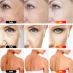 7 in 1 Portable Light Therapy for Face for Body Lamp with Stand, 920nm Red Infrared Light Therapy Device, LED Face Skin Body Skin Care at Home - Image 5