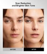 INIA Red Light Therapy Mask for Face, Glow Wireless LED Face Mask Light Therapy with Near-Infrared Red Light (NIR), Rechargeable and Ergonomic Design for Home & Travel - Image 5